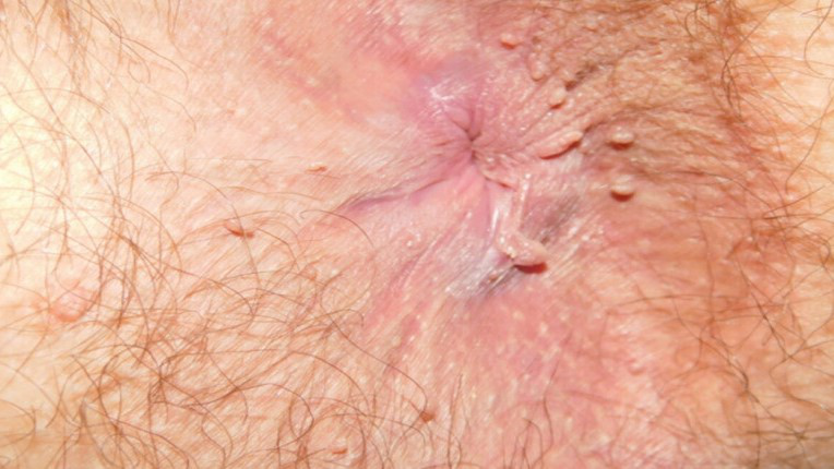 Hình ảnh minh họa